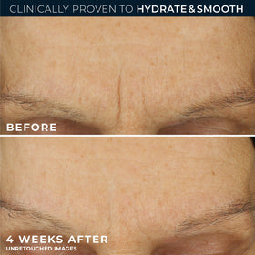 RoC Retinol Correxion Max Hydration Face Moisturizer application on skin