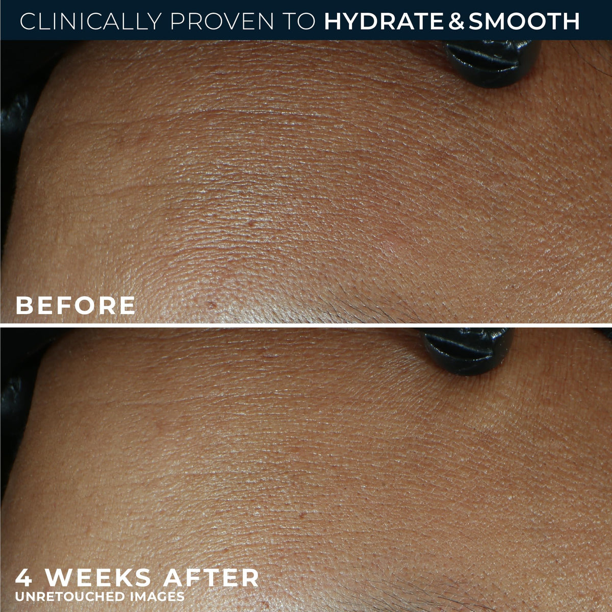 RoC Retinol Correxion Max Hydration Face Moisturizer packaging