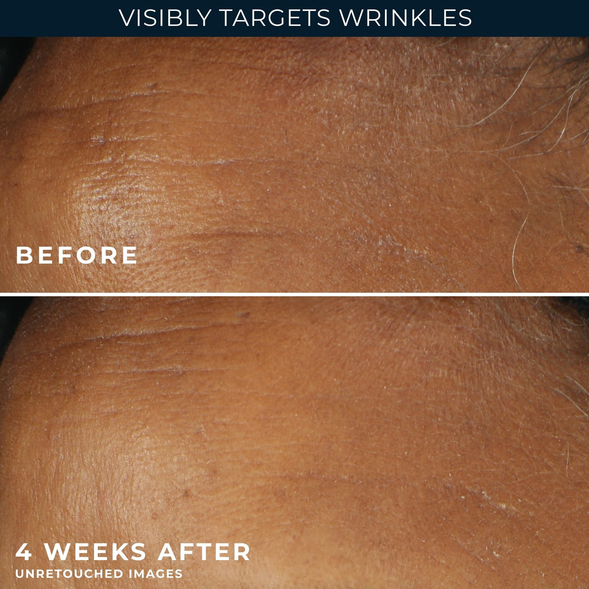 RoC Retinol Correxion moisturizer with a soft towel