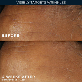 RoC Retinol Correxion moisturizer with a soft towel