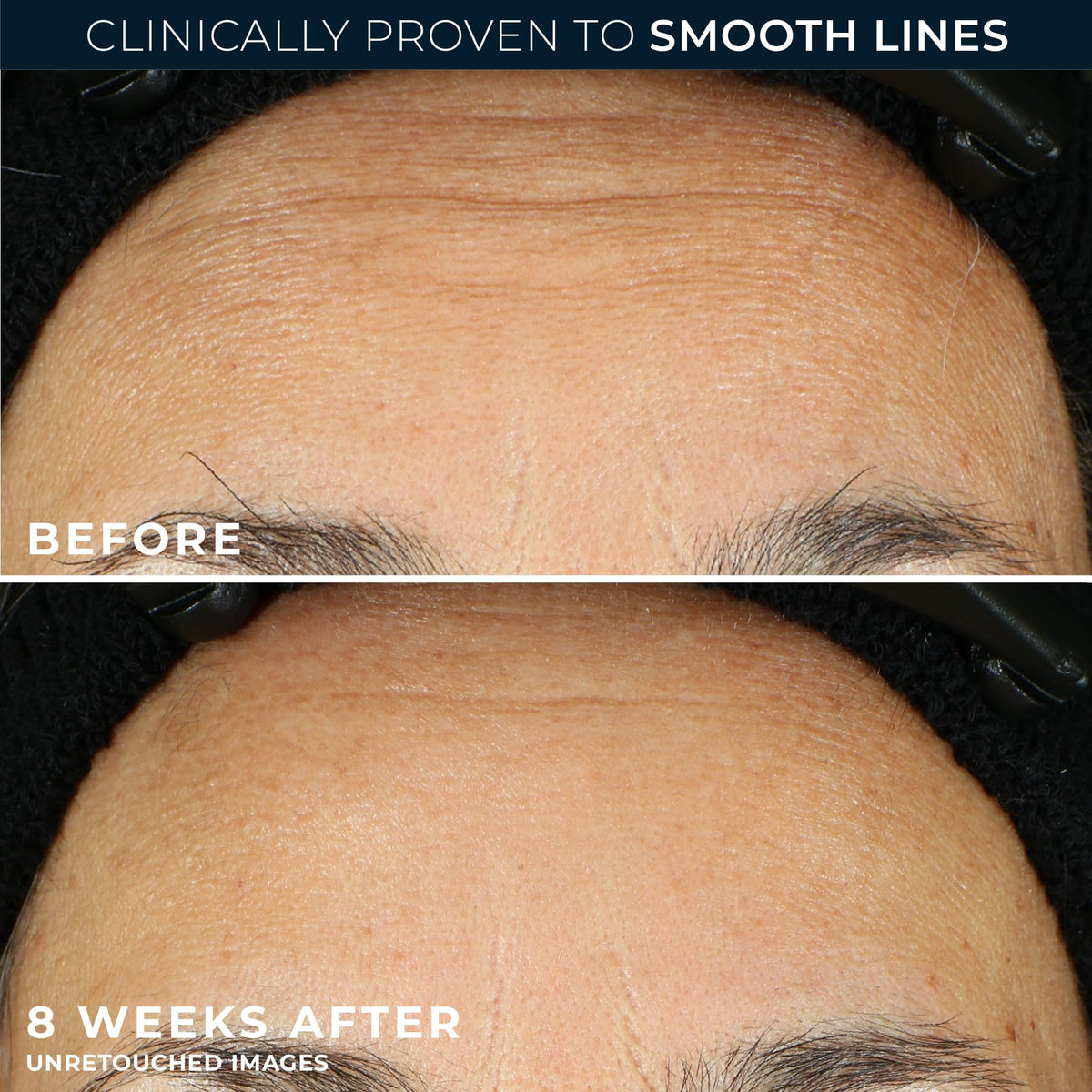 RoC Retinol Correxion Night Serum Capsule opened