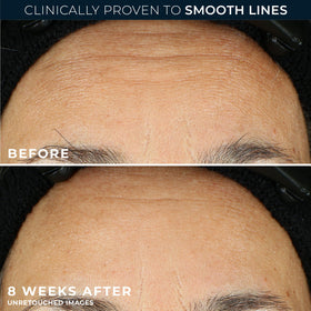 RoC Retinol Correxion Night Serum Capsule opened