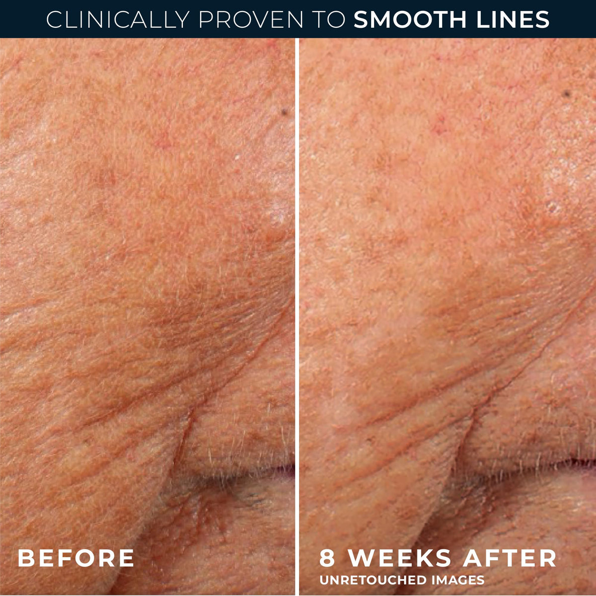 RoC Retinol Correxion Night Serum on skin