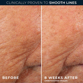 RoC Retinol Correxion Night Serum on skin