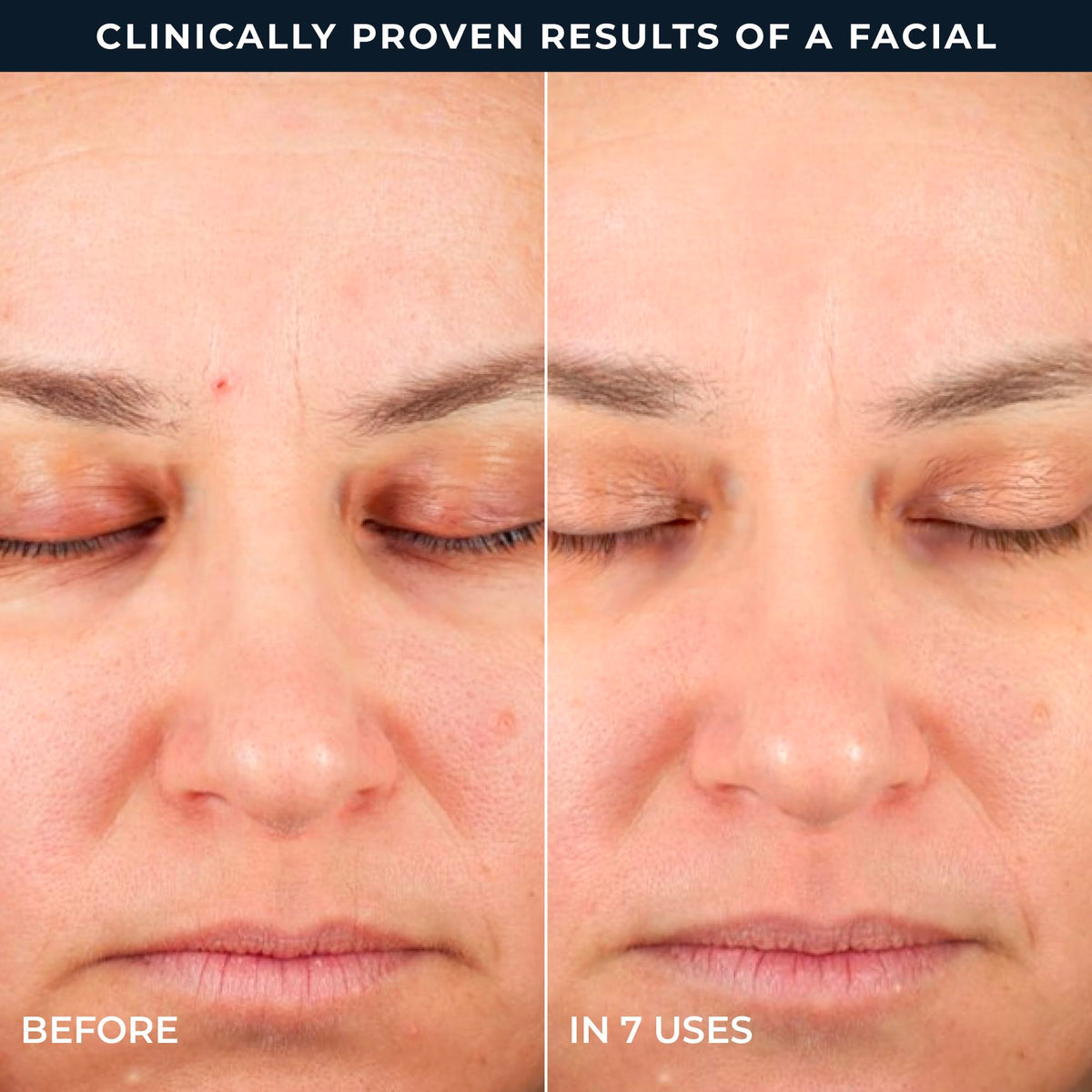RoC Retinol Correxion Peel Pads Step 1 application