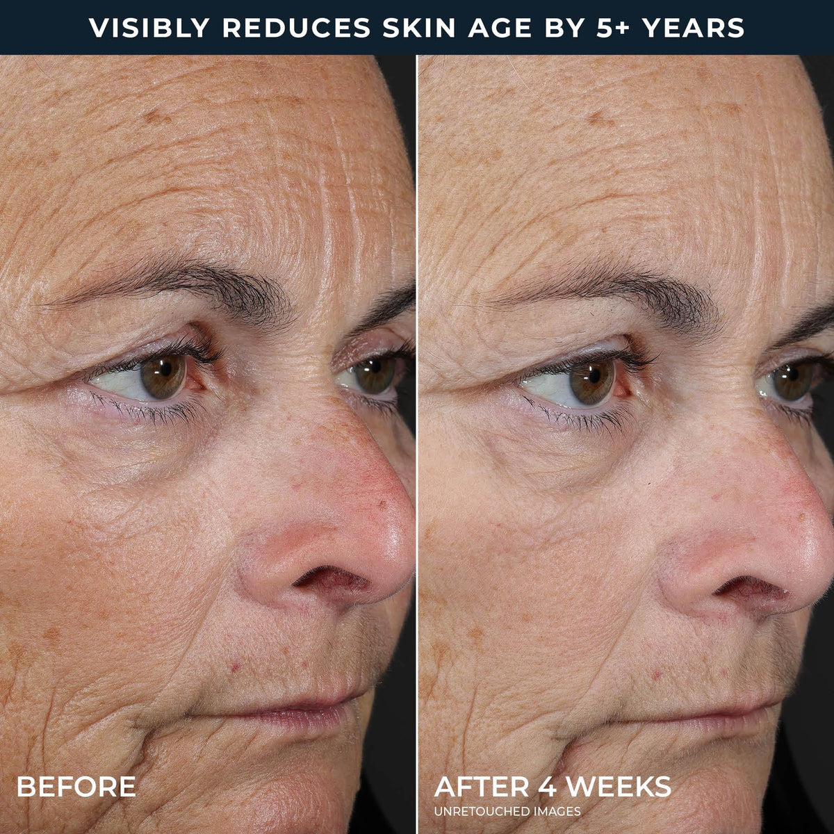 RoC Retinol Correxion Peel Pads Step 2 application