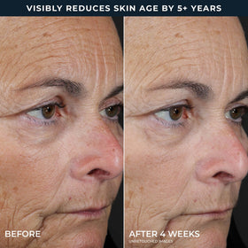 RoC Retinol Correxion Peel Pads Step 2 application