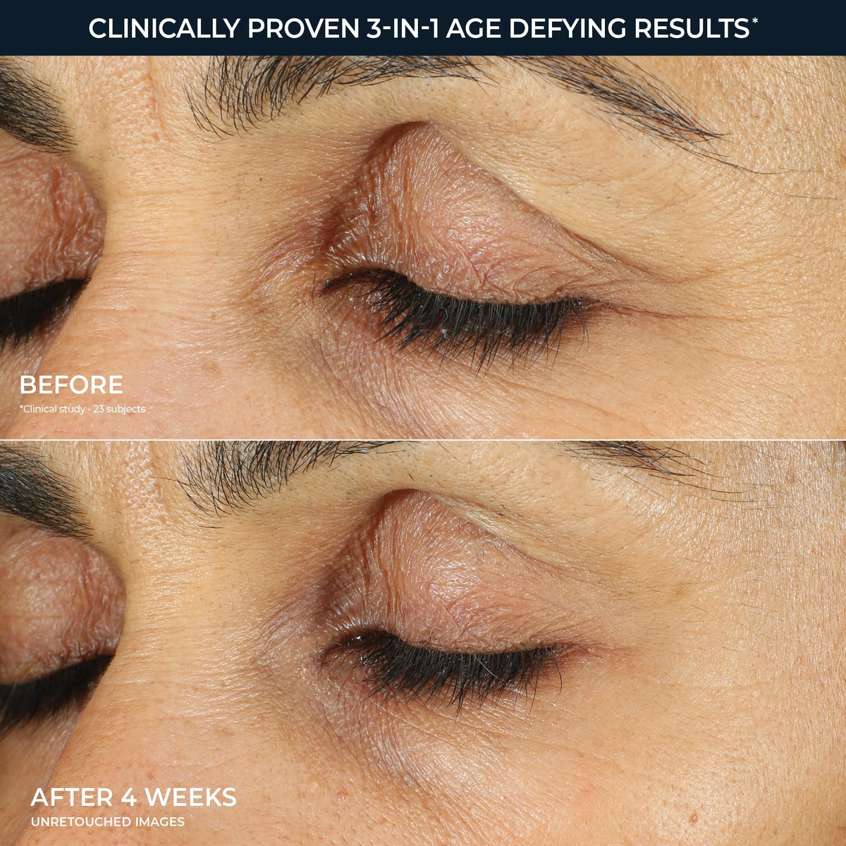 RoC Retinol Correxion Under Eye Cream texture close-up