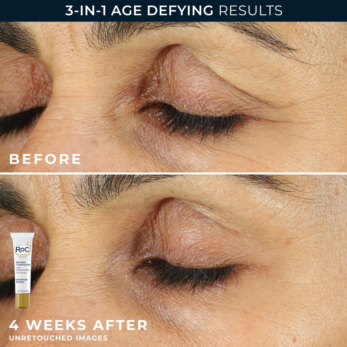 RoC Retinol Correxion Value Set packaging front view