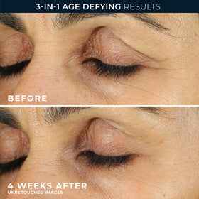 RoC Retinol Eye Cream Mini on a bathroom counter