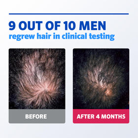 Rogaine Men's 5% Minoxidil Foam with measuring cap
