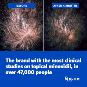 Rogaine Men's Hair Regrowth Foam 5% Minoxidil application process