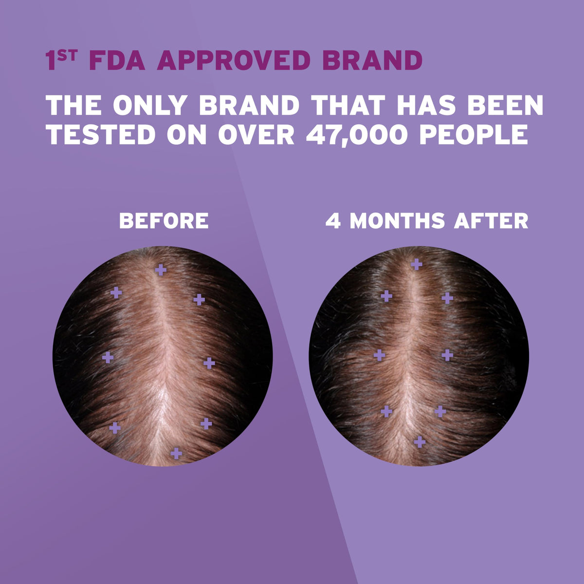 Rogaine Women's 2% Minoxidil Topical Solution back view showing usage instructions
