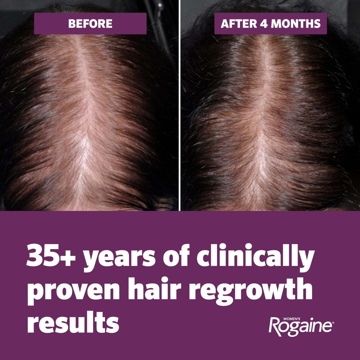 Rogaine Women's Hair Growth Foam packaging details
