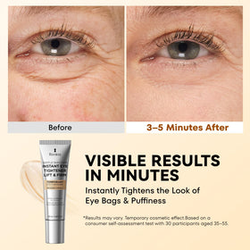 RONKIE Instant Firm Eye Tightener application on skin