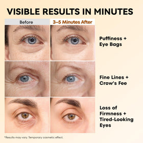 RONKIE Instant Firm Eye Tightener packaging side view