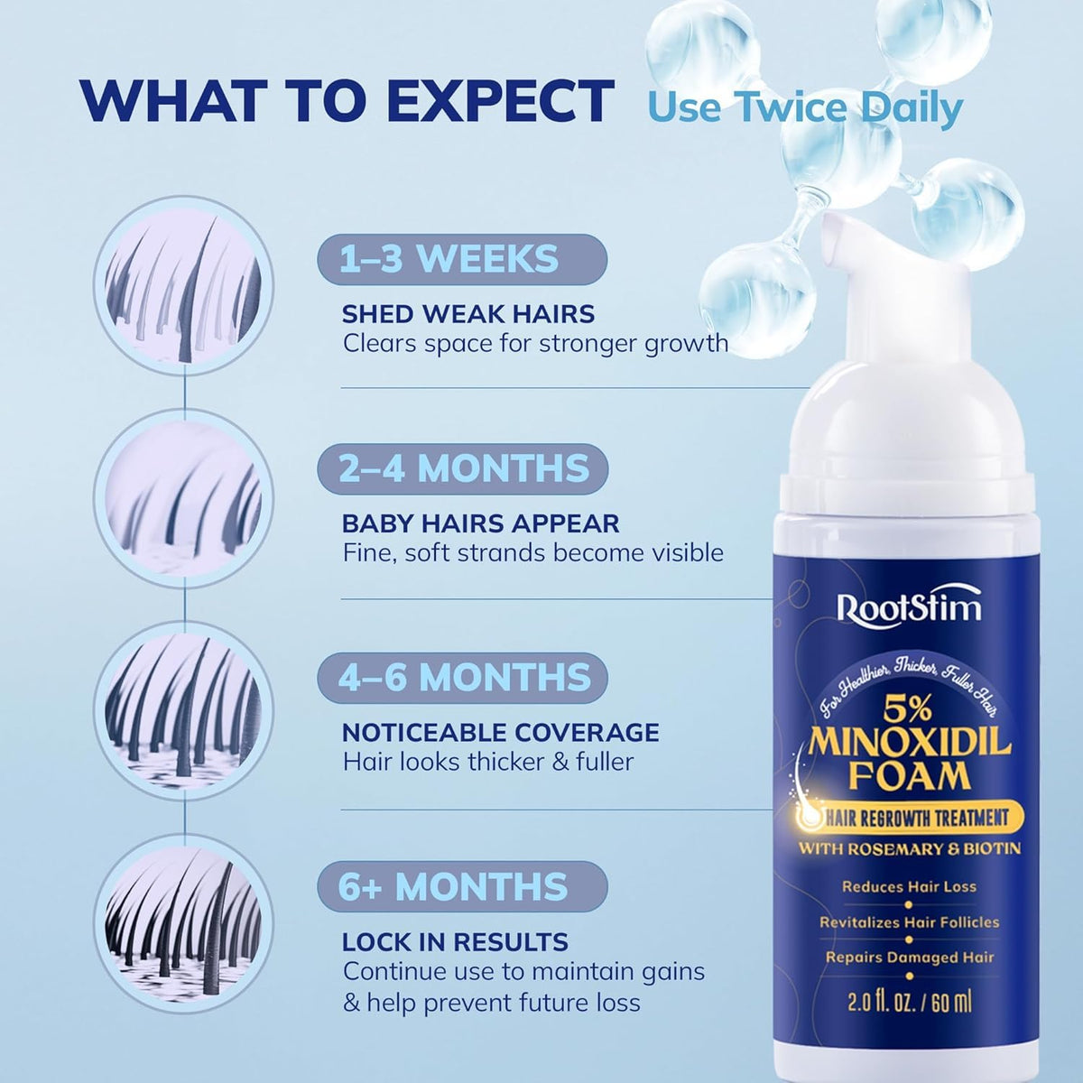RootStim 5% Minoxidil Foam texture close-up