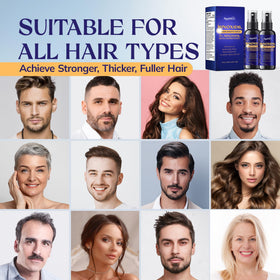RootStim 5% Minoxidil Hair Growth Serum application on hair