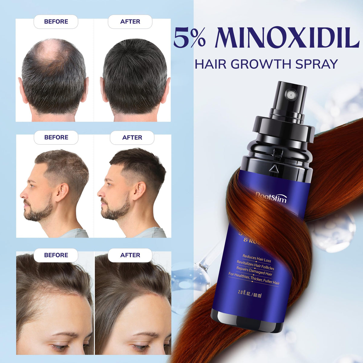 RootStim 5% Minoxidil Hair Growth Serum side view