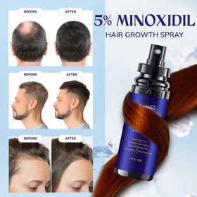 RootStim 5% Minoxidil Hair Growth Serum side view