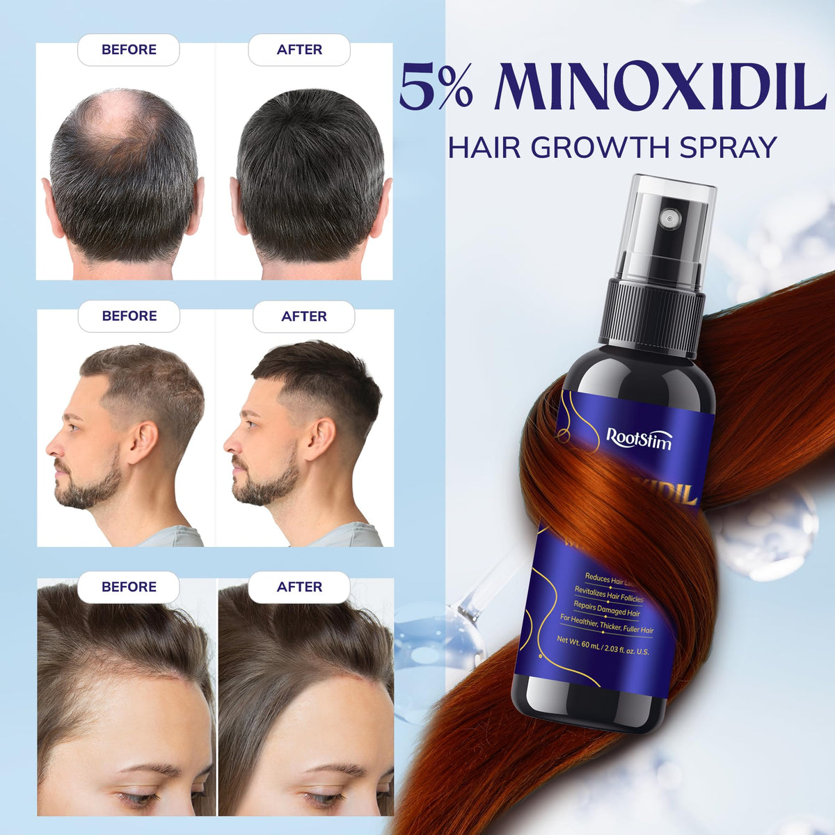 RootStim application instructions on clean hair