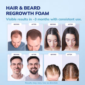 RootStim foam application on hair