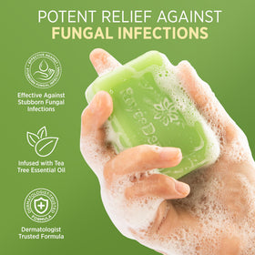 Roycederm Antifungal Bar Soap close-up showing texture