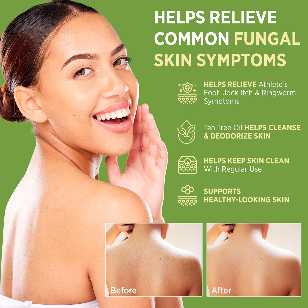 Roycederm Antifungal Bar Soap in packaging