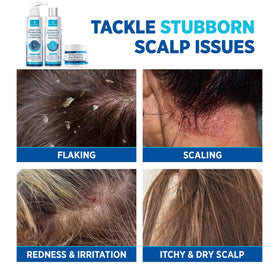 Roycederm Scalp Therapy System shampoo lathering on hand