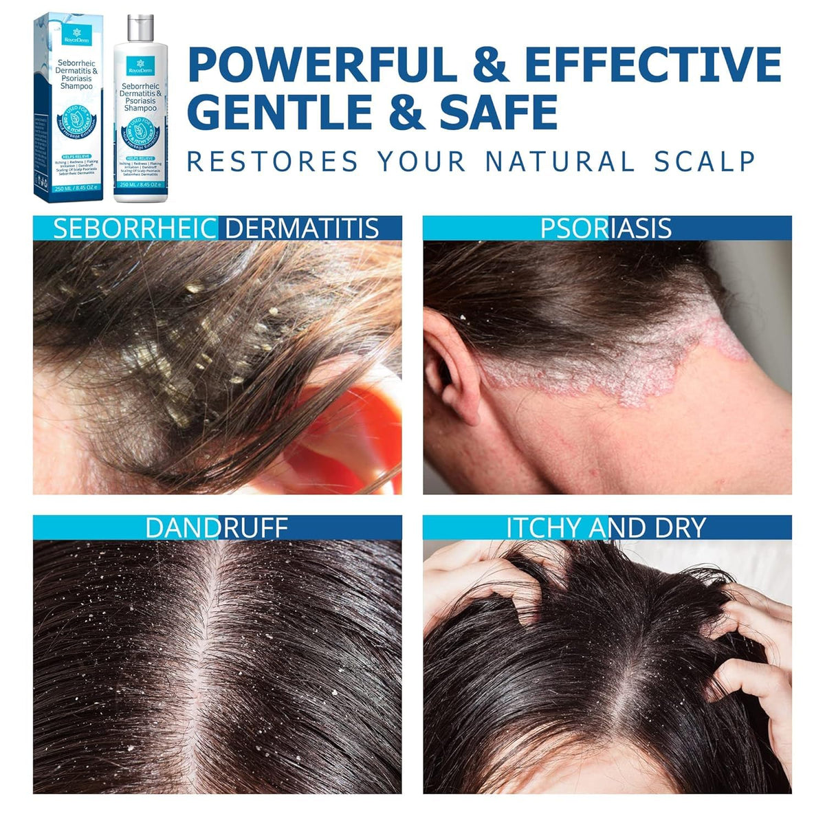 Roycederm Seborrheic Dermatitis Shampoo 331g texture close-up