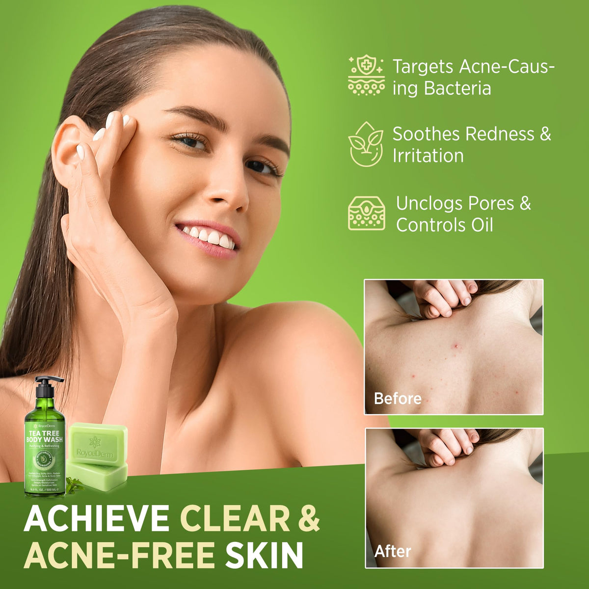 Roycederm Tea Tree Soap Bar close-up