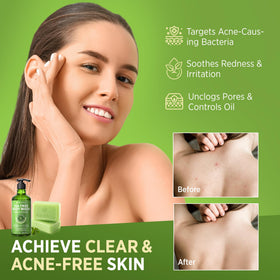Roycederm Tea Tree Soap Bar close-up