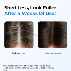 Seapuri Scalpy Hair Growth Serum 20g side view