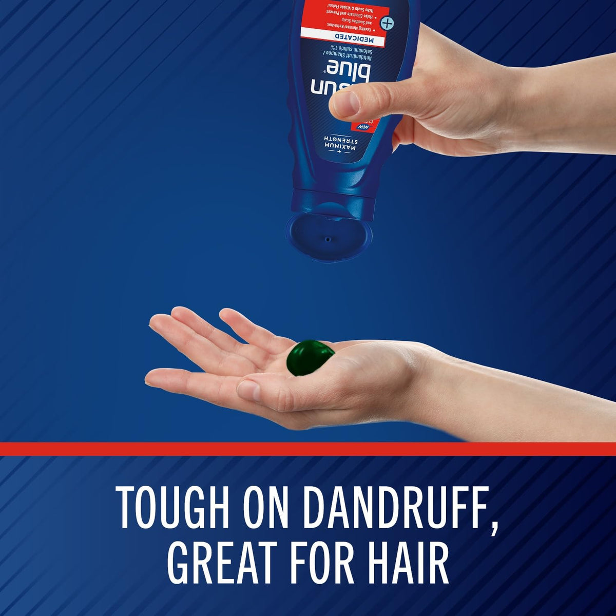 Selsun Blue Medicated Antidandruff Shampoo with cap open