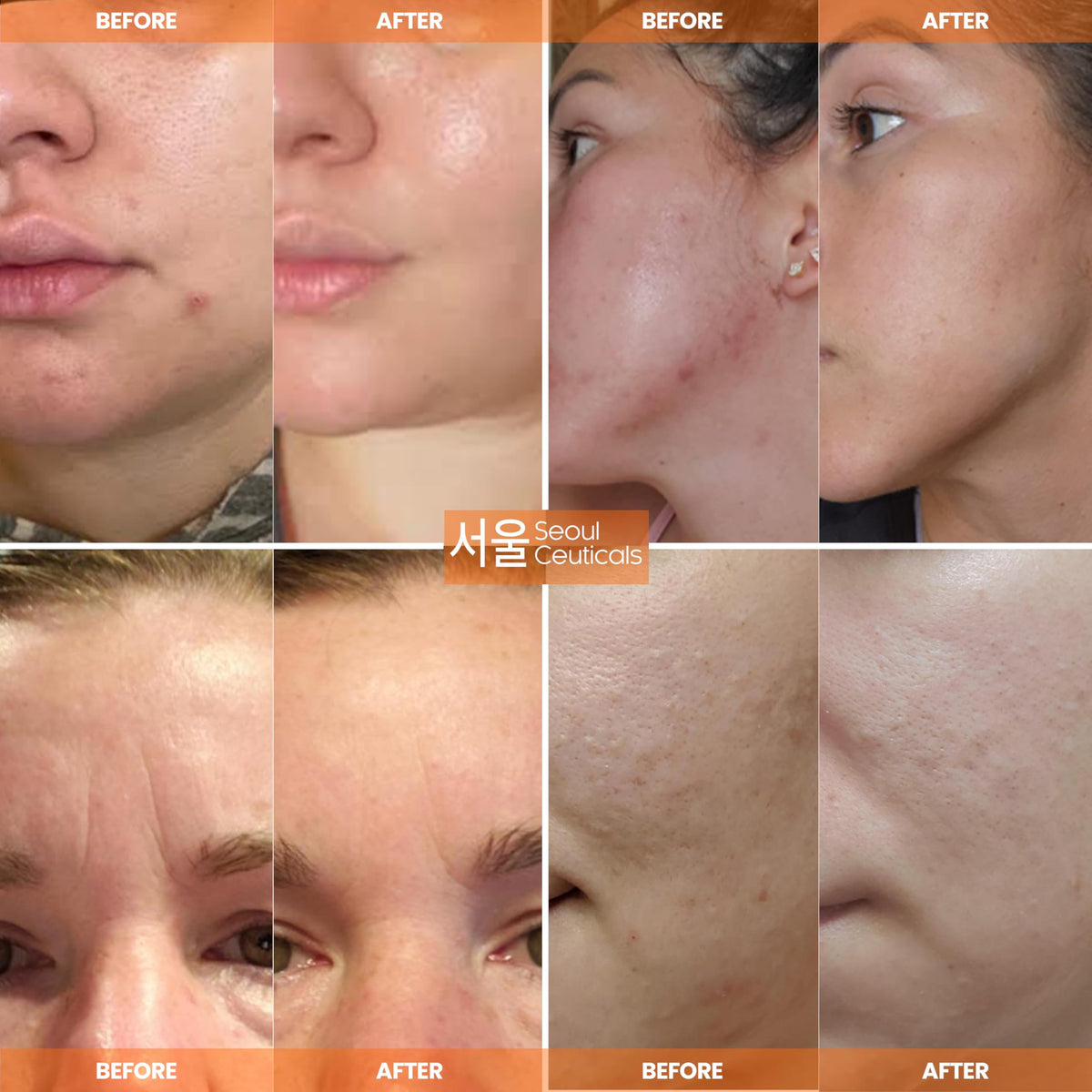 SeoulCeuticals moisturizer packaging with ingredients list