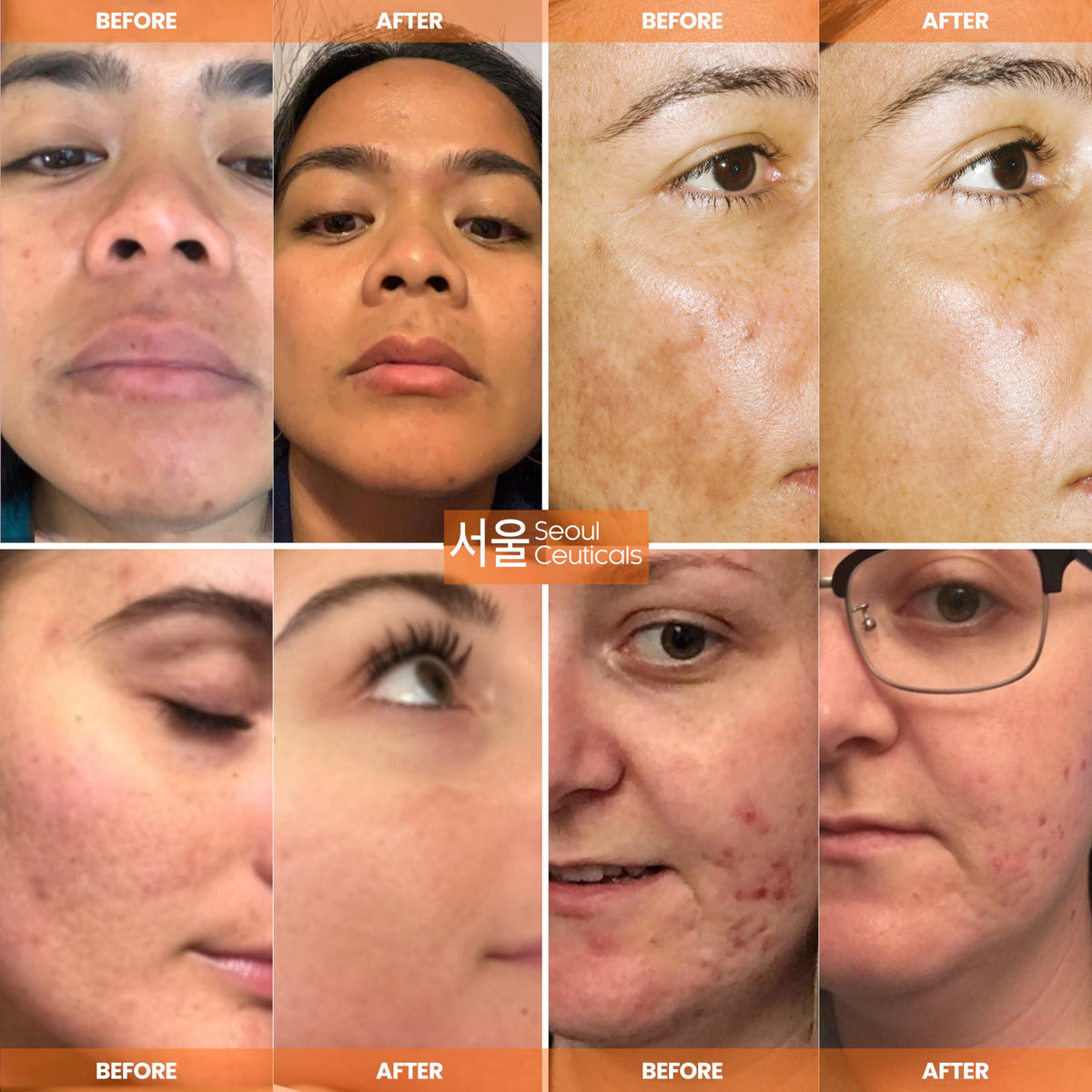 SeoulCeuticals Vitamin C Serum dropper close-up