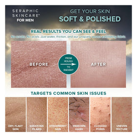 SERAPHIC SKINCARE Exfoliating Mitt showing size and fit