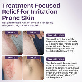 Shailee Antifungal Body Wash in shower setting