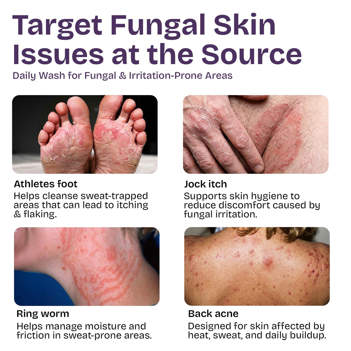 Shailee Antifungal Body Wash texture close-up