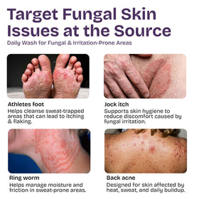 Shailee Antifungal Body Wash texture close-up