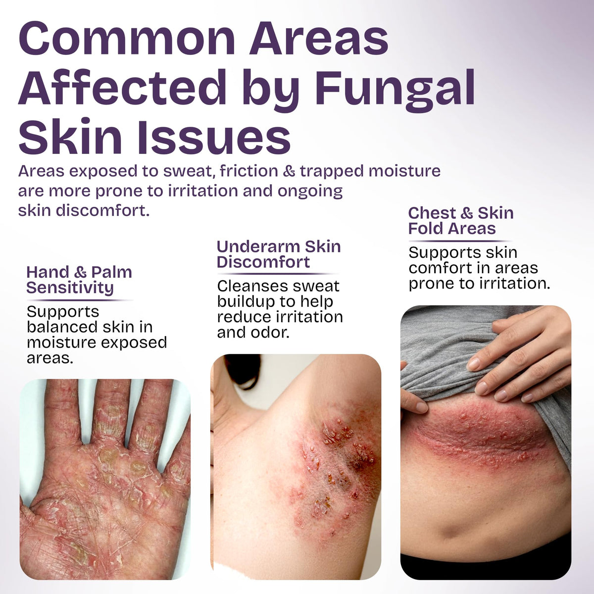 Shailee Antifungal Body Wash with peppermint essence
