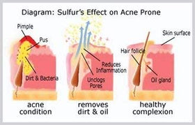 Side view of JOESOEF Anti-Acne Soap bar