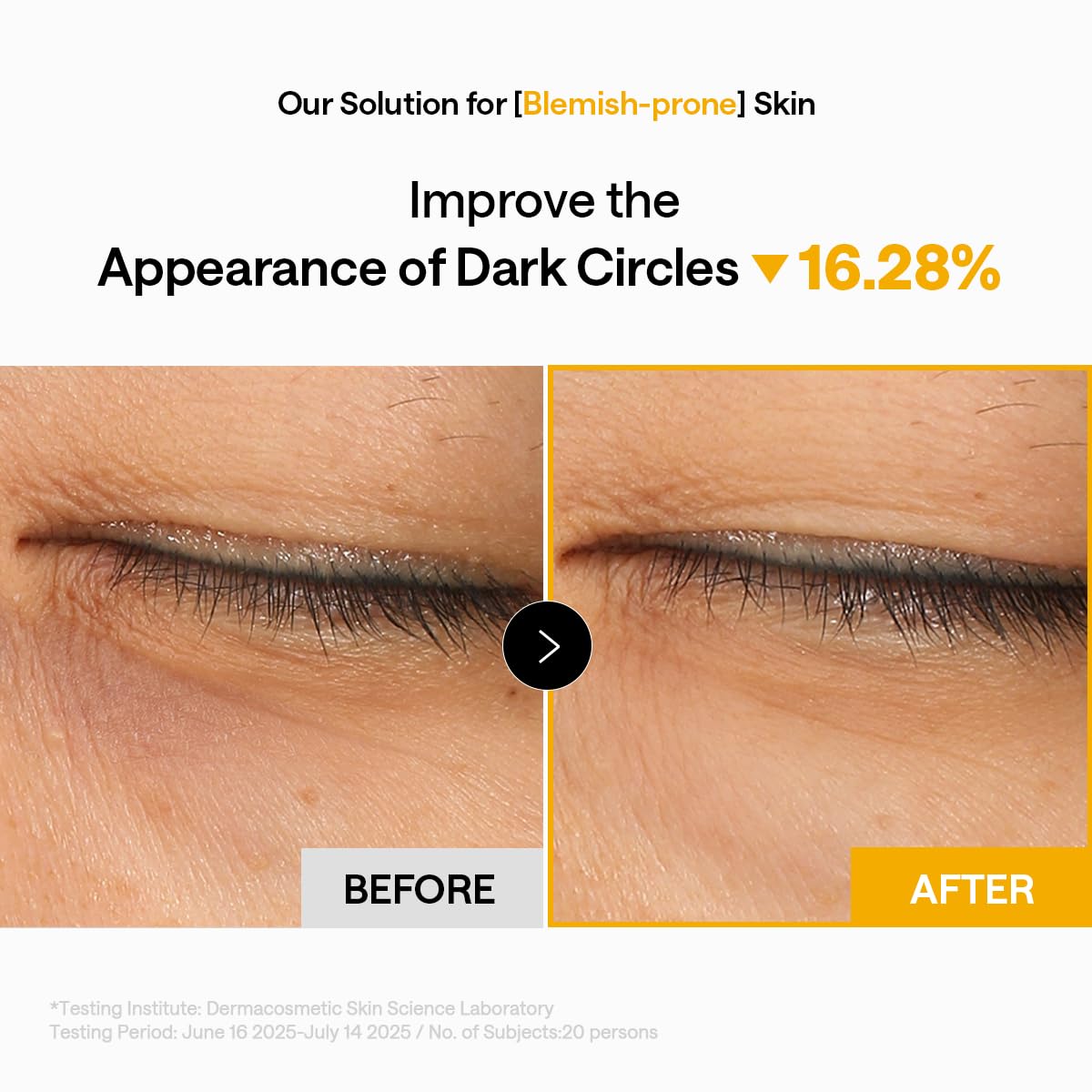 Side view of MEDIHEAL eye patches showing texture
