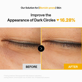 Side view of MEDIHEAL eye patches showing texture