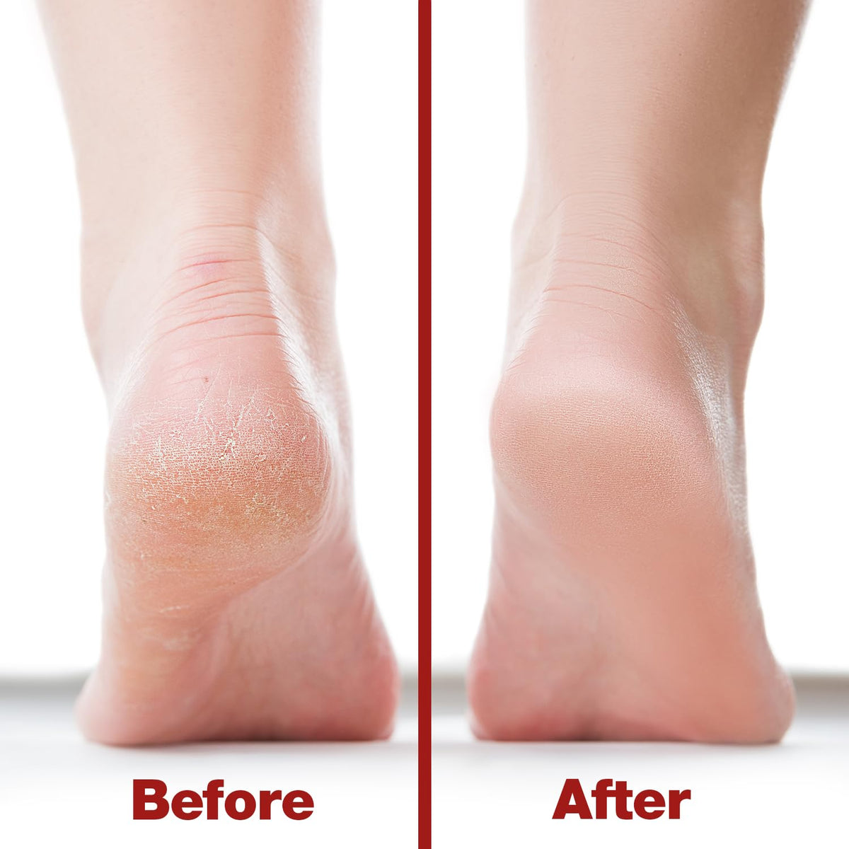 Side view of Probelle Double Sided Foot File