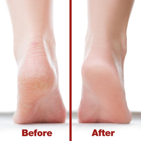 Side view of Probelle Double Sided Foot File