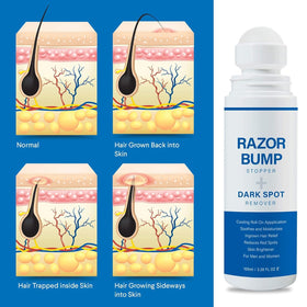Sielkin Razor Bump Stopper application on skin