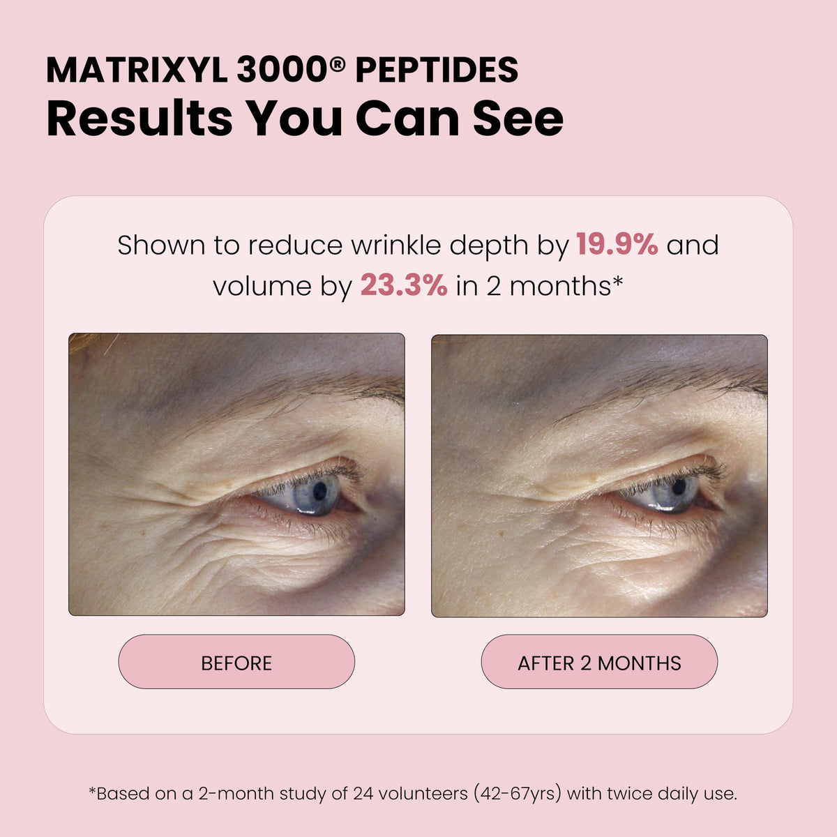 Simplified Skin Rose Water Spray in lifestyle setting