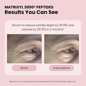 Simplified Skin Rose Water Spray in lifestyle setting