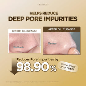 SKIN1004 cleansing oil in a bathroom setting